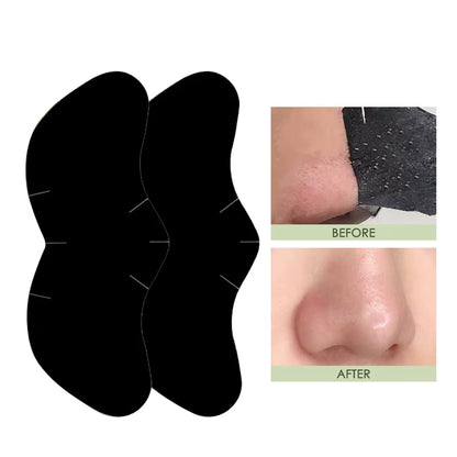 Blackhead Nose Patch Deep Cleansing, Nose Spots, Facial Spot Patch, Quickly Removes Blackheads, Restores Fresh Nose
