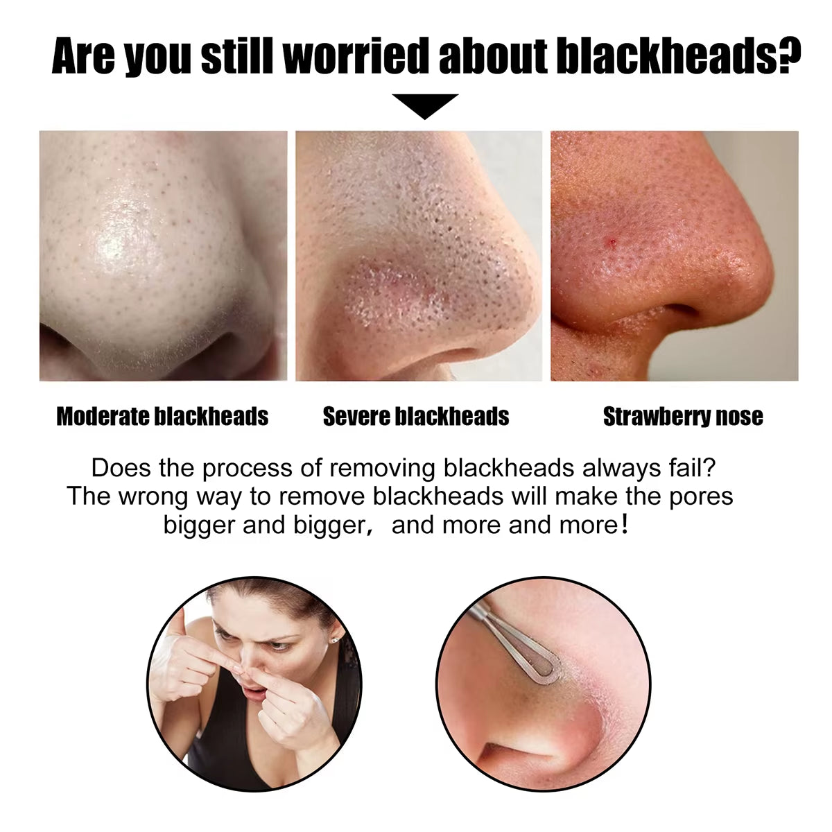 Blackhead Nose Patch Deep Cleansing, Nose Spots, Facial Spot Patch, Quickly Removes Blackheads, Restores Fresh Nose