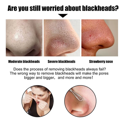 Blackhead Nose Patch Deep Cleansing, Nose Spots, Facial Spot Patch, Quickly Removes Blackheads, Restores Fresh Nose